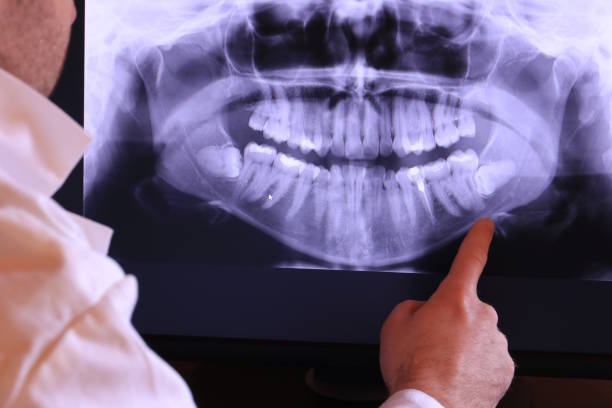 Best Emergency Broken Tooth Repair in Chenoa, IL